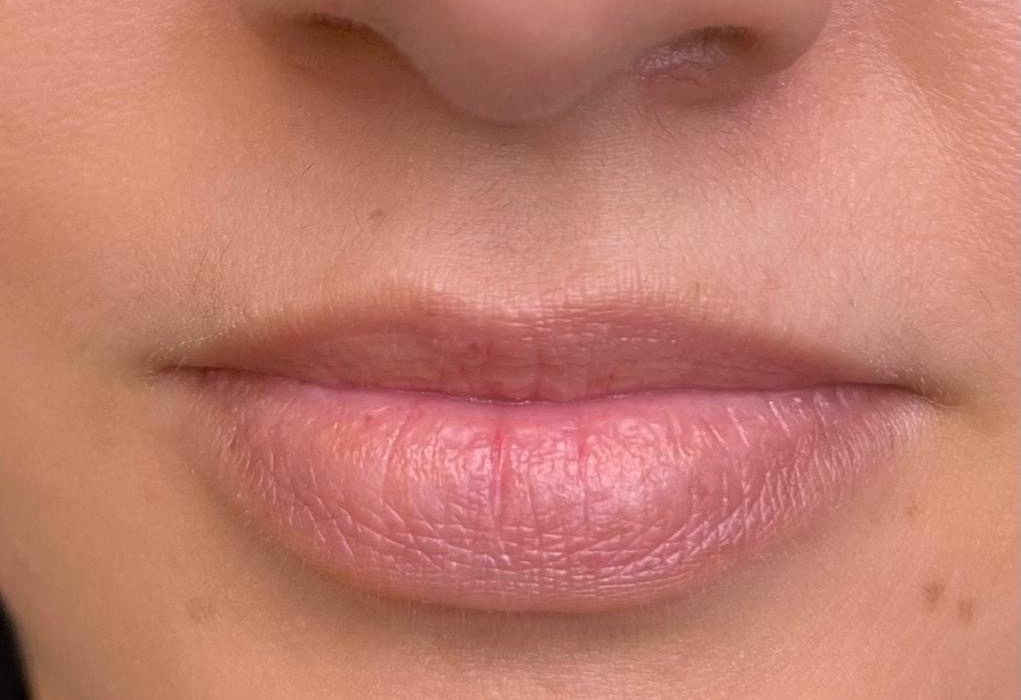 Labios antes de la micropigmentación